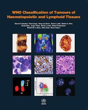 WHO classification of tumours of haematopoietic and lymphoid tissues